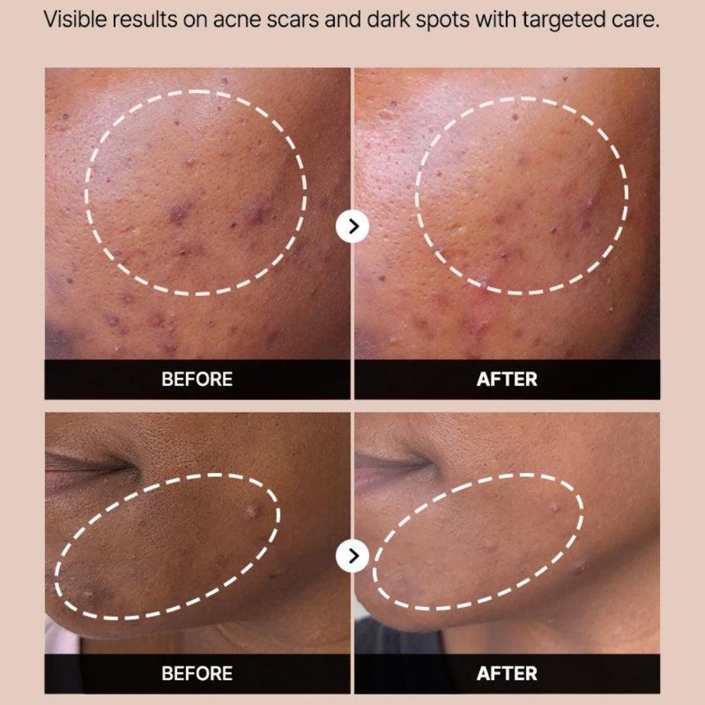 Cosrx The Alpha-Arbutin 2 Care Serum 50ml