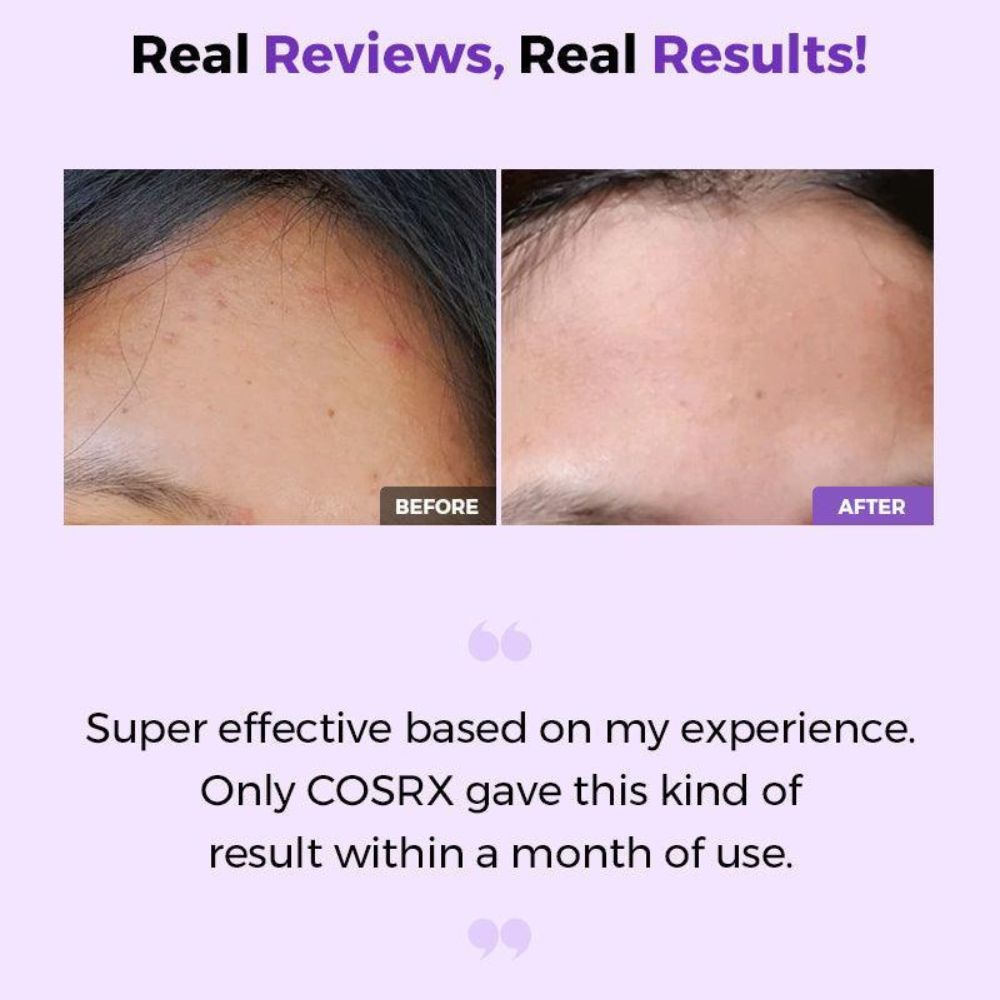 Cosrx Aha/Bha Clarifying Treatment Toner 150ml