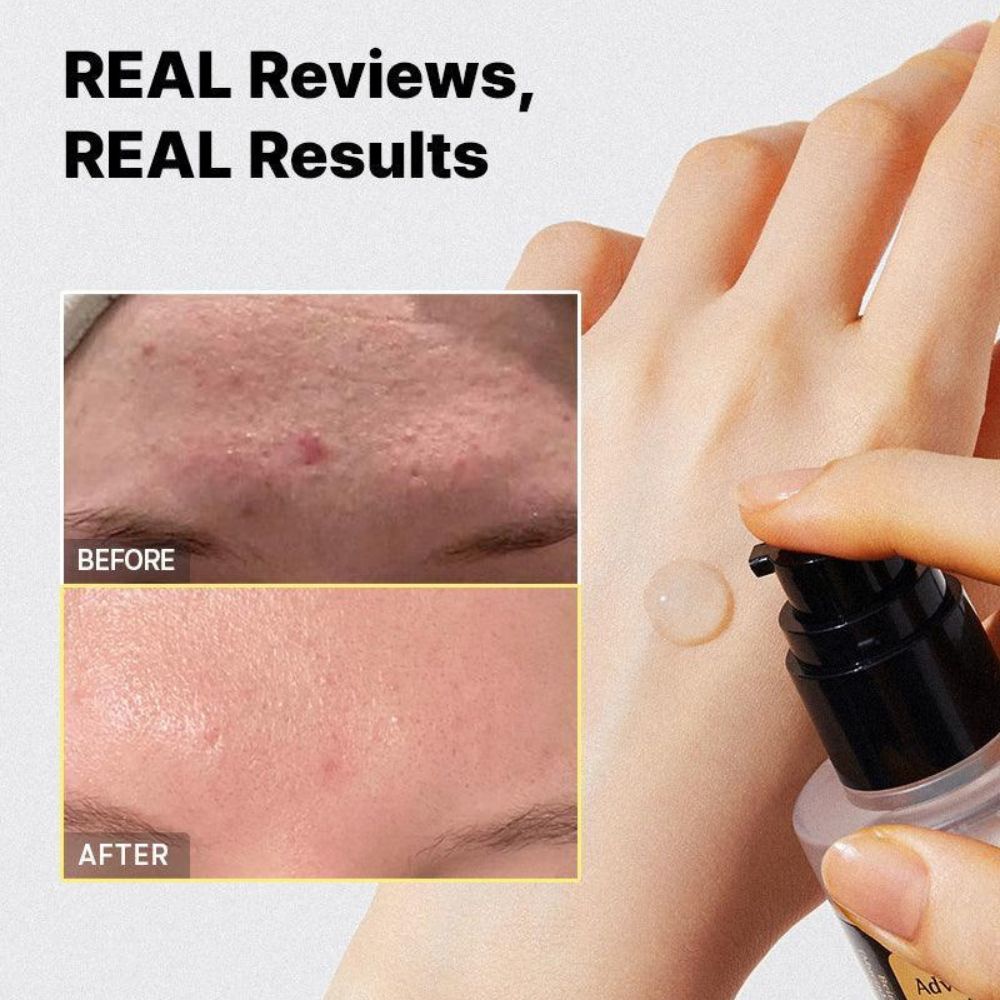 COSRX ADVANCE SNAIL 96 MUCIN POWER ESSENCE 100ML