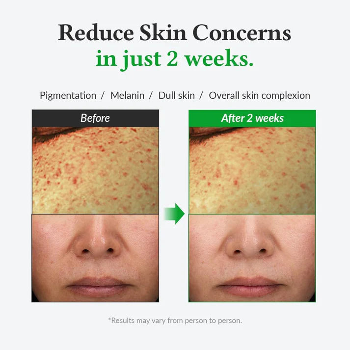 Dr. Althea Vitamin C Boosting Serum 30ml