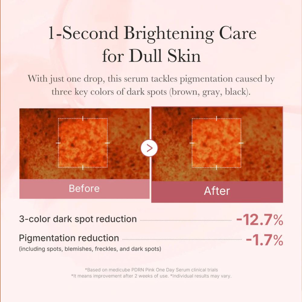 MEDICUBE- PDRN PINK ONE DAY SERUM (1.5ML X 10EA)