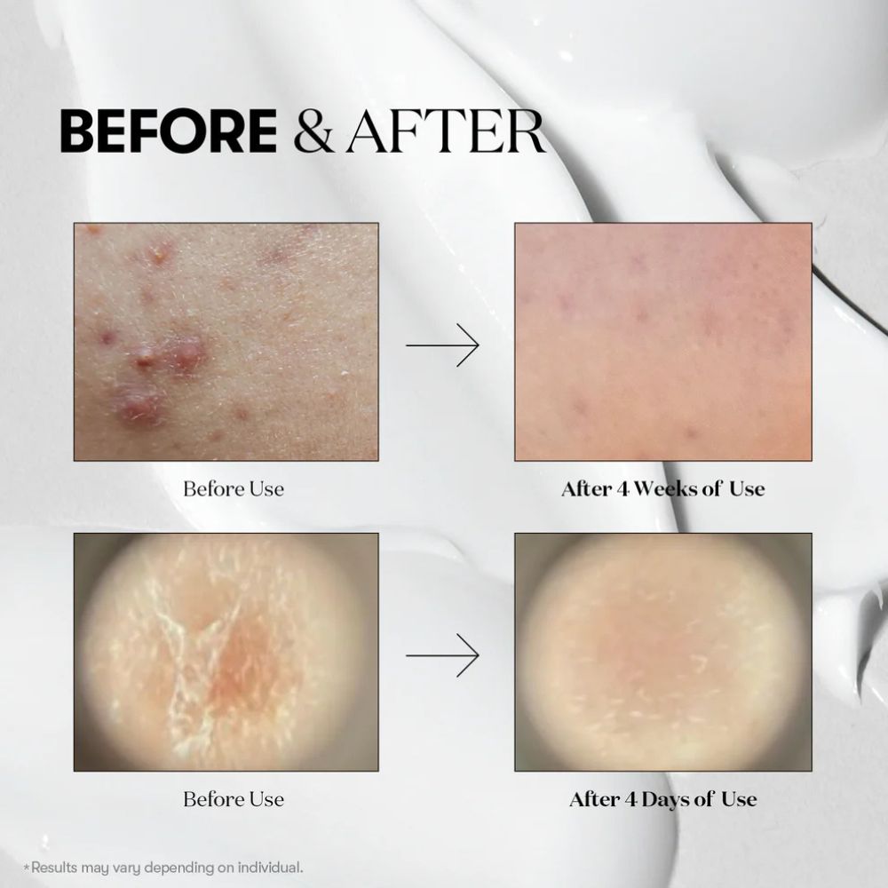 Vt Cosmetics Reedle Shot 300