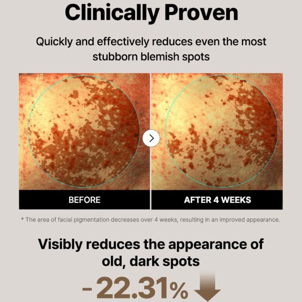 Cosrx The Alpha-Arbutin 2 Care Serum 50ml