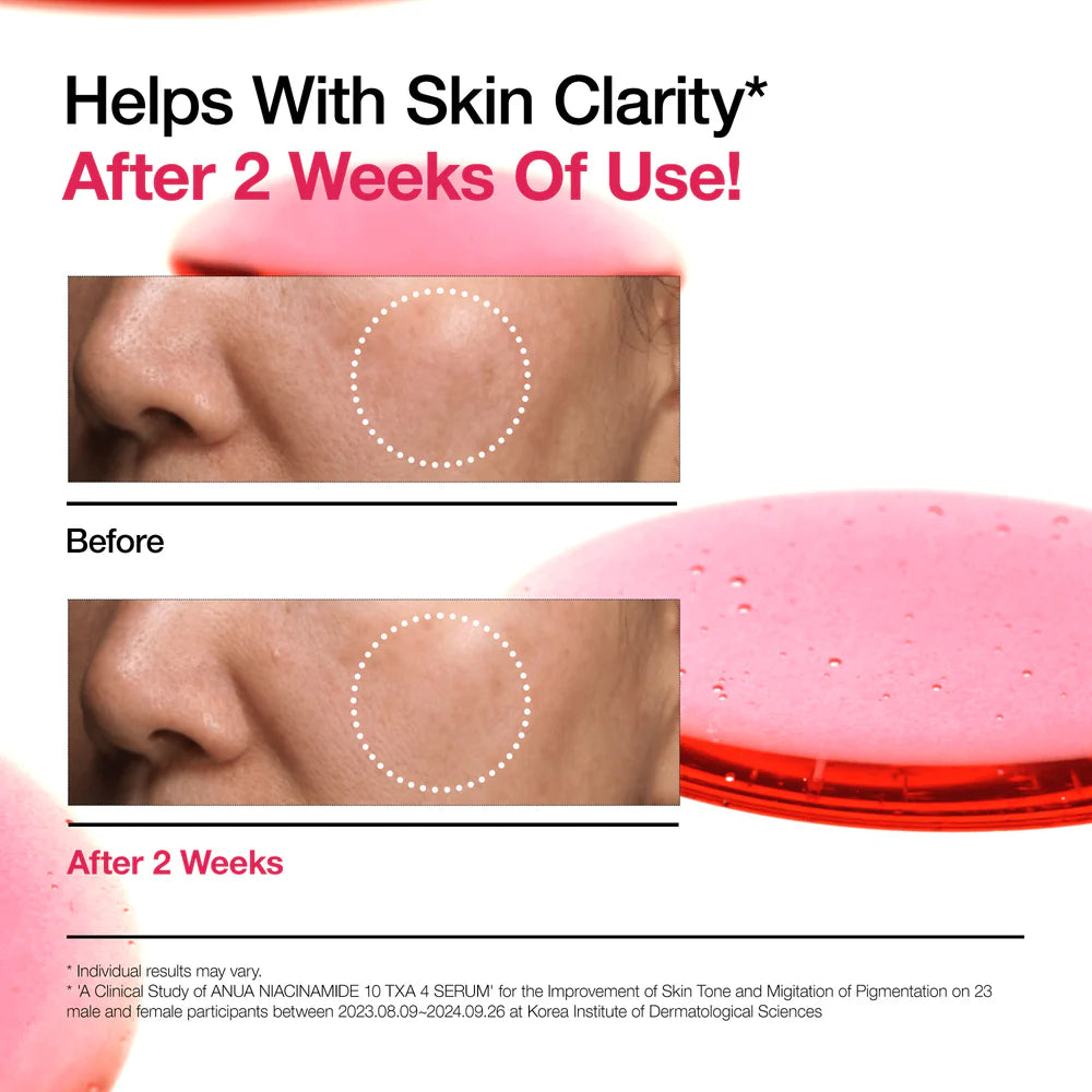 ANUA NIACINAMIDE 10% + TXA 4% SERUM 30ML
