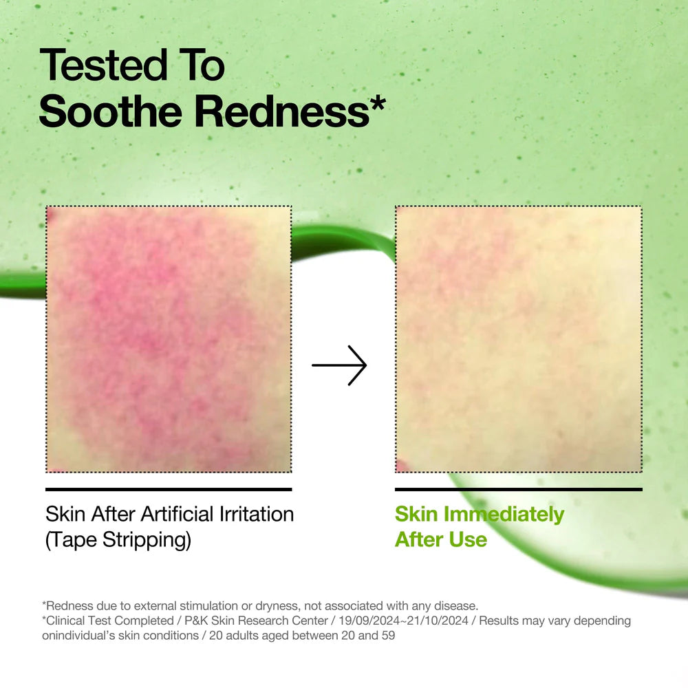 ANUA AZELAIC ACID 10 HYALURON REDNESS SOOTHING SERUM 30ML